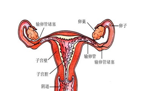 输卵管不通怎么办，输卵管不通有什么症状
